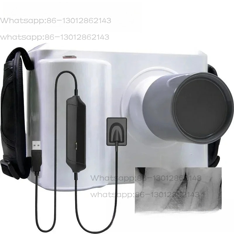 เครื่องเอกซเรย์ทันตกรรมแบบพกพา - Veterinary X Ray Machine บทวิจารณ์และราคา