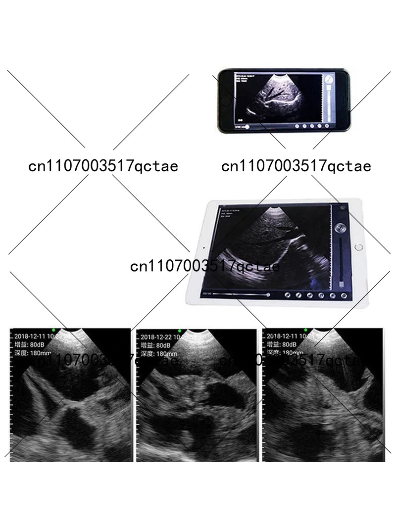 เครื่องสแกนอัลตราซาวนด์ไร้สาย  - Livestock Ultrasound Pregnancy บทวิจารณ์และราคา