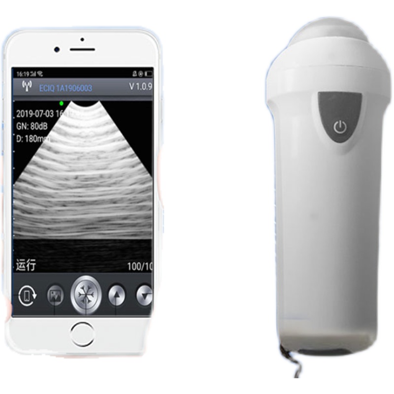 เครื่องอัลตราซาวนด์สัตวแพทย์แบ - Livestock Ultrasound Pregnancy บทวิจารณ์และราคา
