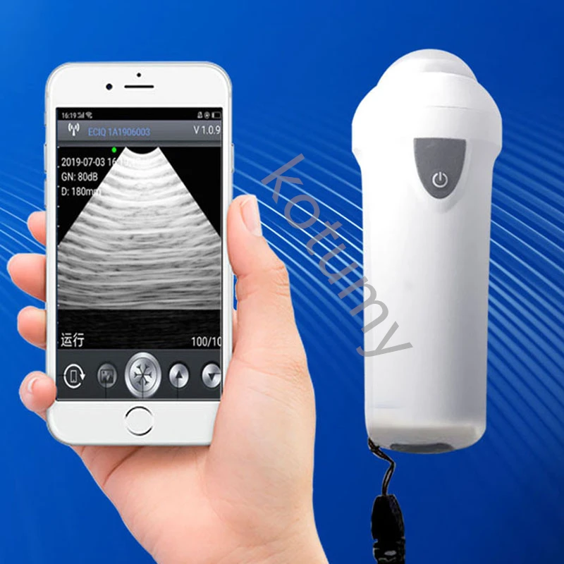 เครื่องอัลตราซาวนด์สัตวแพทย์แบ - Livestock Ultrasound Pregnancy บทวิจารณ์และราคา