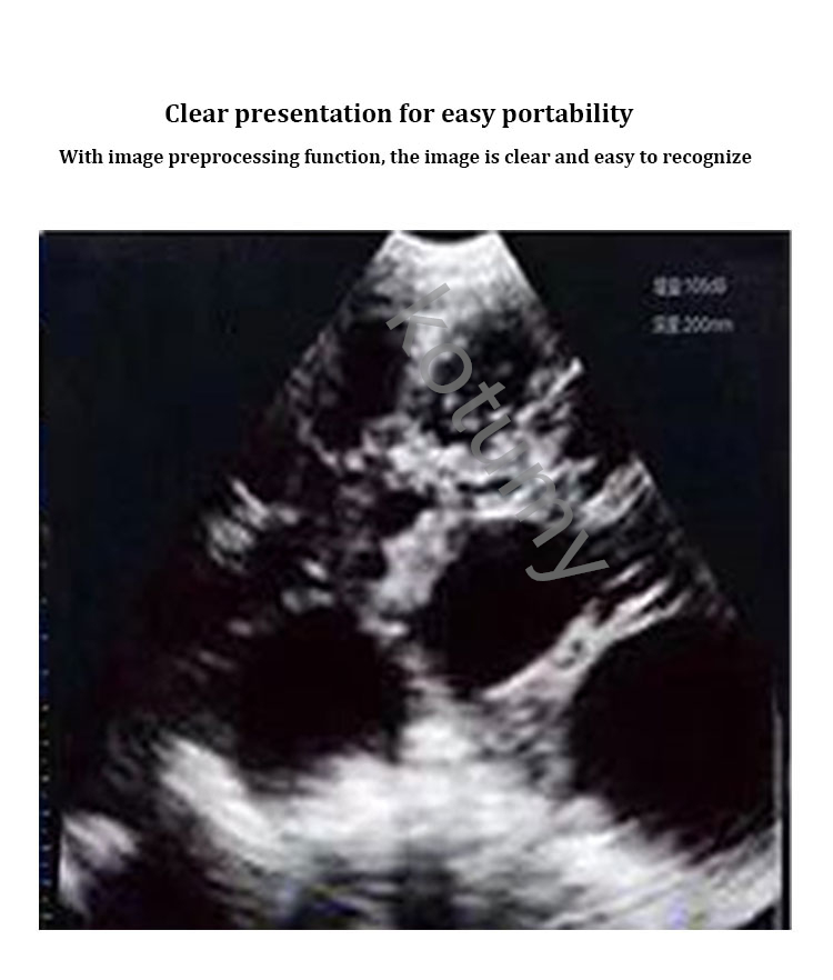 เครื่องอัลตราซาวนด์สัตวแพทย์แบ - Livestock Ultrasound Pregnancy บทวิจารณ์และราคา