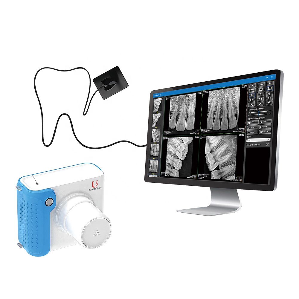 Photon-นับทันตกรรม-สัตวแพทย์Xr - Veterinary X Ray Machine บทวิจารณ์และราคา