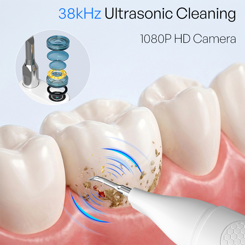 เครื่องทำความสะอาดฟันด้วยคลื่น - Veterinary Dental Scaler บทวิจารณ์และราคา