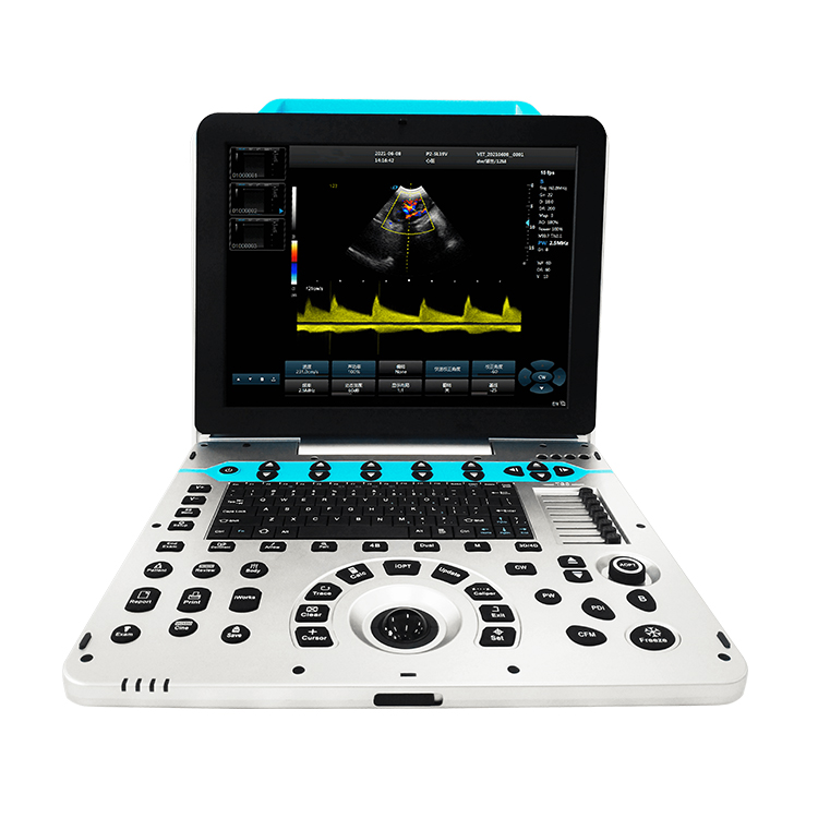 เครื่องสแกนสัตว์แบบพกพา VUP5 เ - Veterinary Ultrasound Scanner Portable บทวิจารณ์และราคา