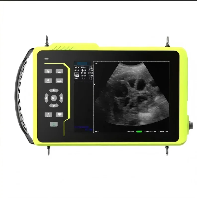 #   เครื่องสแกนระบบอัลตราซาวด์ - Veterinary Ultrasound Scanner Portable บทวิจารณ์และราคา