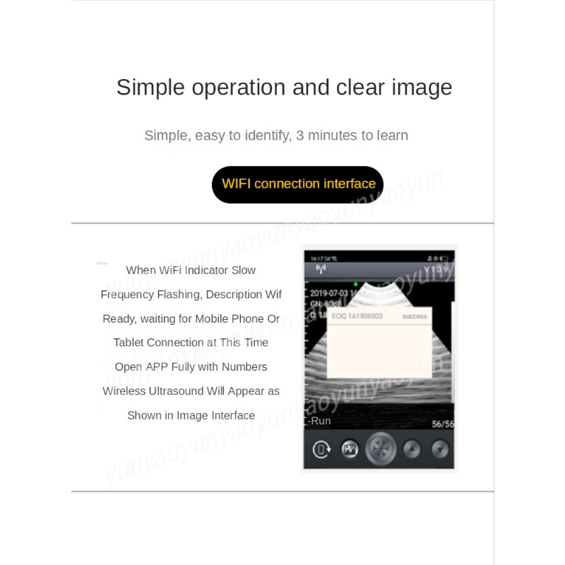 เครื่องสแกนอัลตราซาวนด์ไร้สายแ - Livestock Ultrasound Pregnancy บทวิจารณ์และราคา