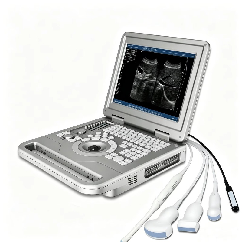 เครื่องอัลตราซาวด์สัตวแพทย์แบบ - Veterinary Ultrasound Scanner Portable บทวิจารณ์และราคา