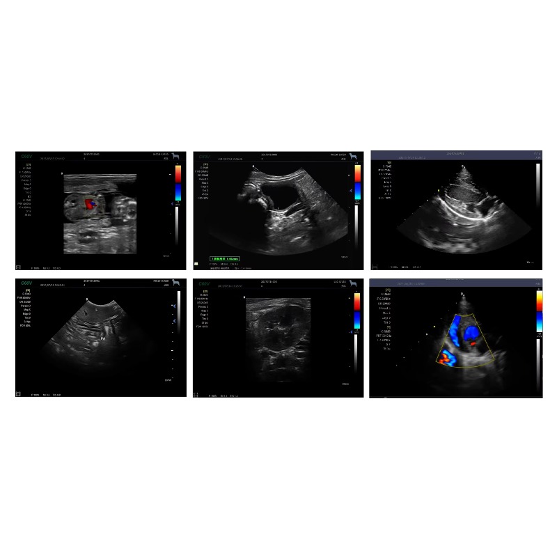 เครื่องอัลตราซาวด์สัตวแพทย์แบบ - Veterinary Ultrasound Scanner Portable บทวิจารณ์และราคา