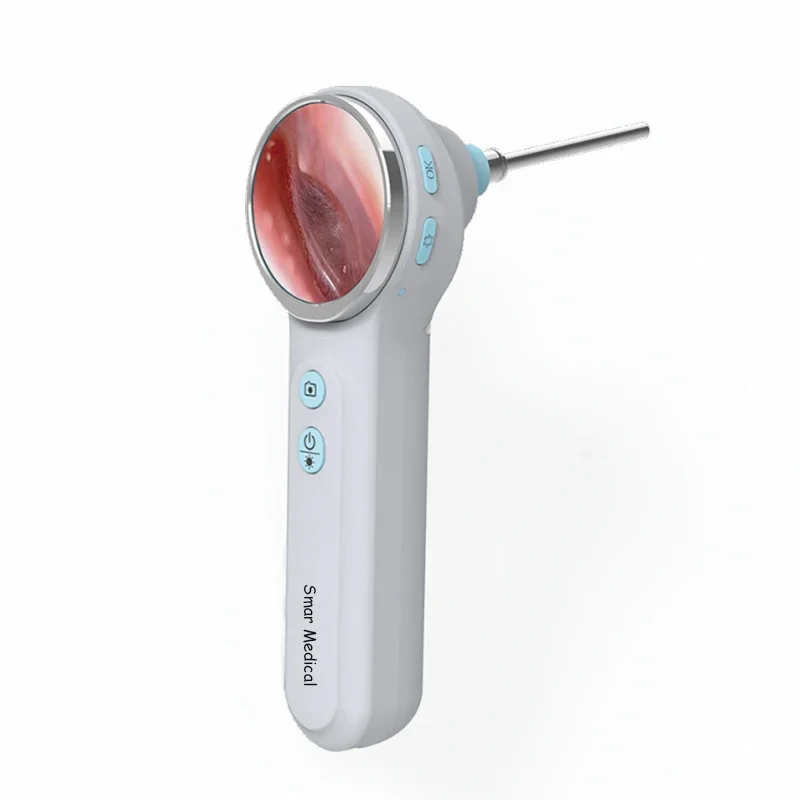 ราคาโรงงานถูก กล้องส่องหูแบบวิ - Veterinary Otoscope บทวิจารณ์และราคา