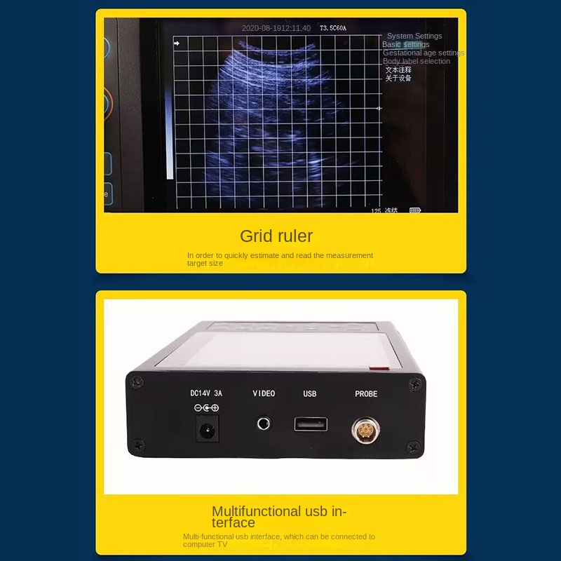 เครื่องสแกนอัลตราซาวด์สัตวแพทย - Livestock Ultrasound Pregnancy บทวิจารณ์และราคา