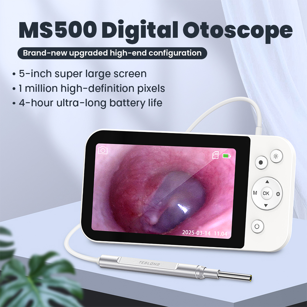 กล้องตรวจหูสัตว์แบบไร้สายชนิดแ - Veterinary Otoscope บทวิจารณ์และราคา