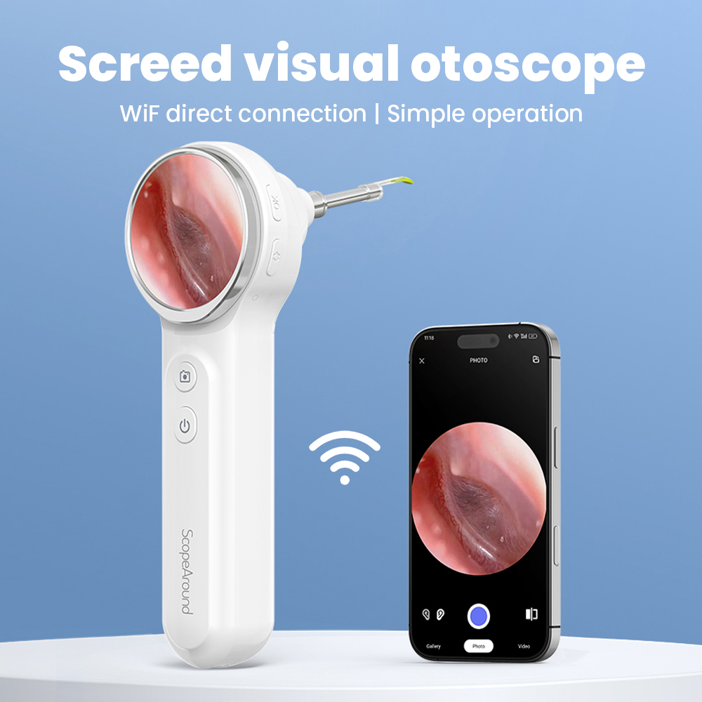 กล้องตรวจหูสัตว์แบบไร้สายชนิดแ - Veterinary Otoscope บทวิจารณ์และราคา