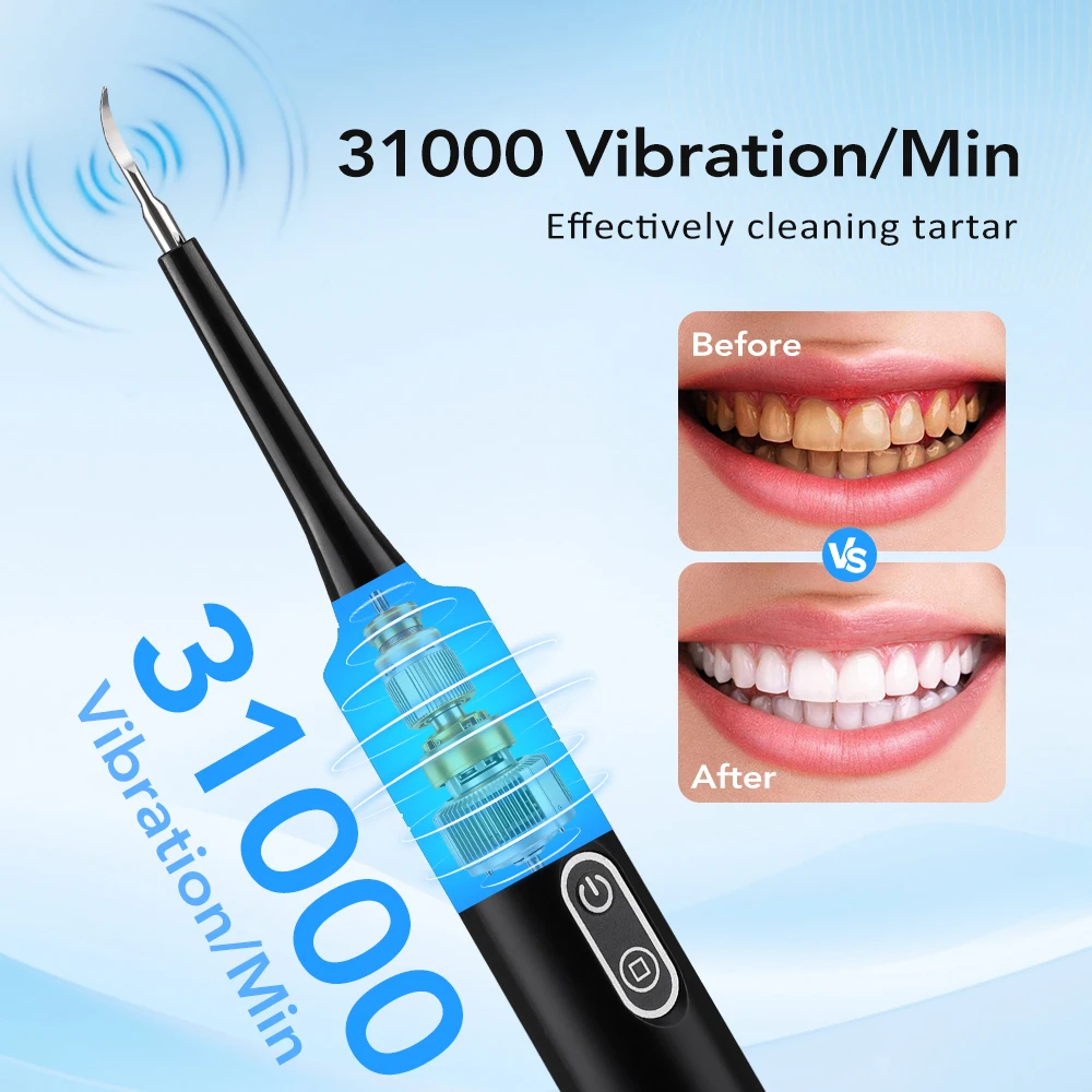 เครื่องขจัดคราบหินปูนไฟฟ้าแบบส - Veterinary Dental Scaler บทวิจารณ์และราคา